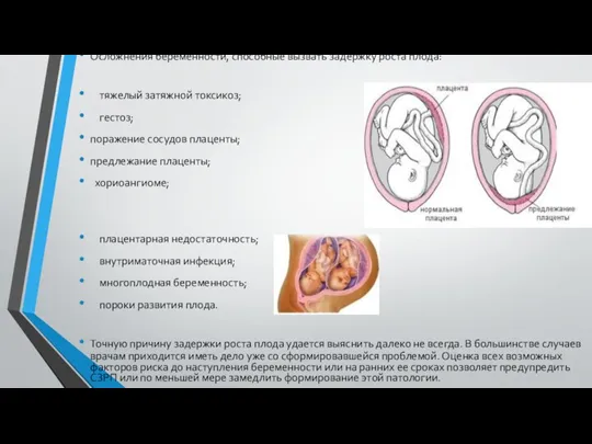 Осложнения беременности, способные вызвать задержку роста плода: тяжелый затяжной токсикоз;