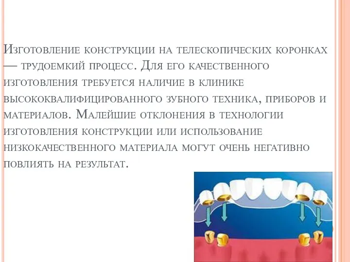 Изготовление конструкции на телескопических коронках — трудоемкий процесс. Для его