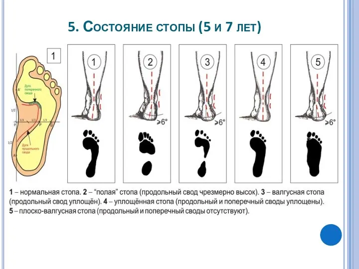 5. Состояние стопы (5 и 7 лет)