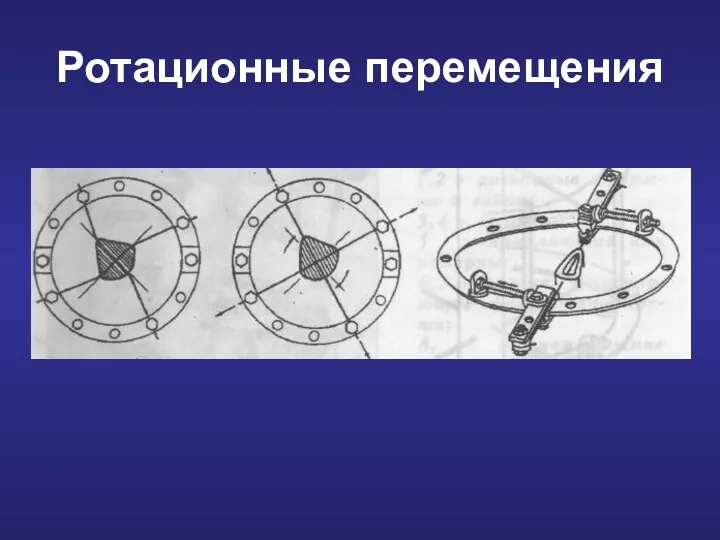 Ротационные перемещения