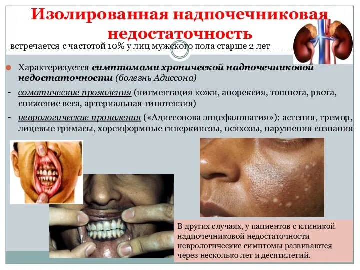 Изолированная надпочечниковая недостаточность Характеризуется симптомами хронической надпочечниковой недостаточности (болезнь Адиссона)