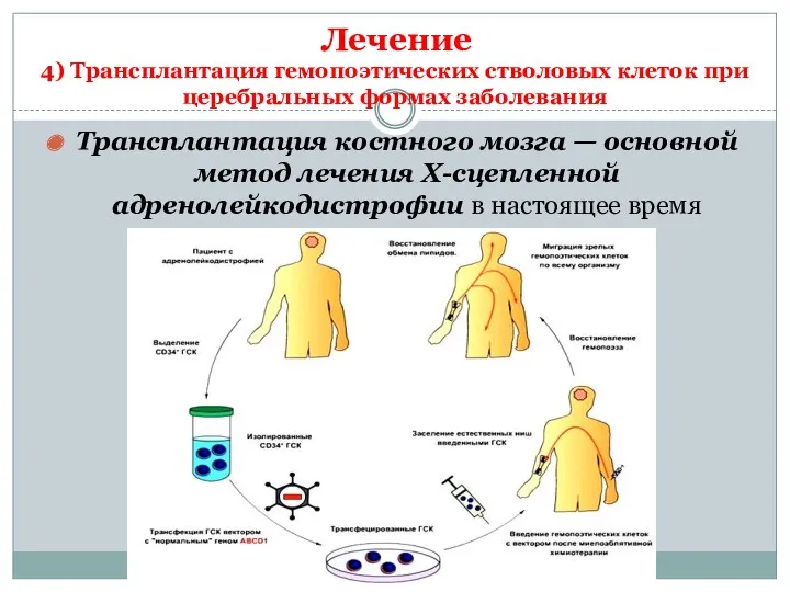 Трансплантация костного мозга — основной метод лечения Х-сцепленной адренолейкодистрофии в