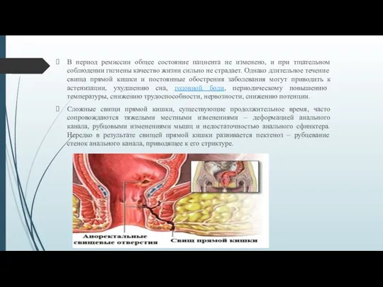 В период ремиссии общее состояние пациента не изменено, и при