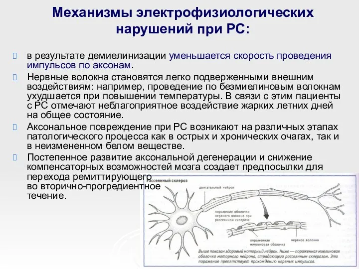 Механизмы электрофизиологических нарушений при РС: в результате демиелинизации уменьшается скорость