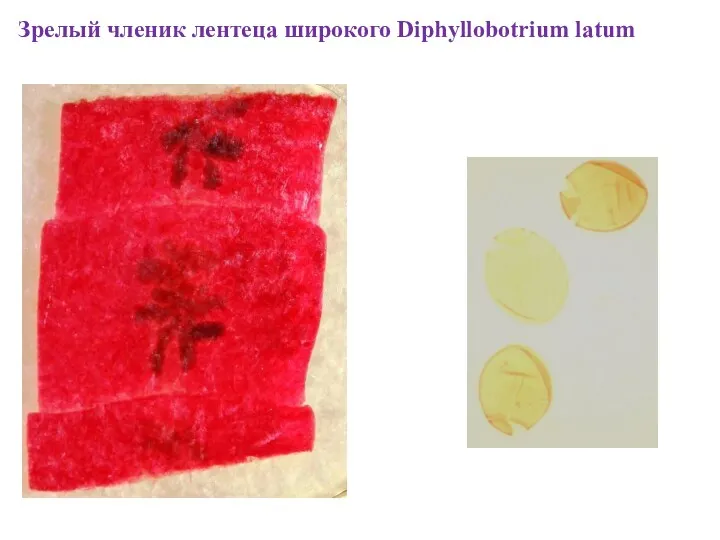 Зрелый членик лентеца широкого Diphyllobotrium latum