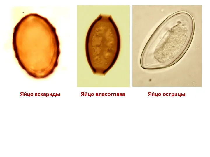 Яйцо острицы Яйцо власоглава Яйцо аскариды
