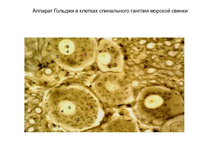 Аппарат Гольджи в клетках спинального ганглия морской свинки
