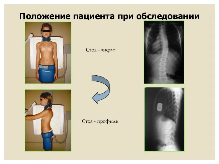 Положение пациента при обследовании Стоя - анфас Стоя - профиль