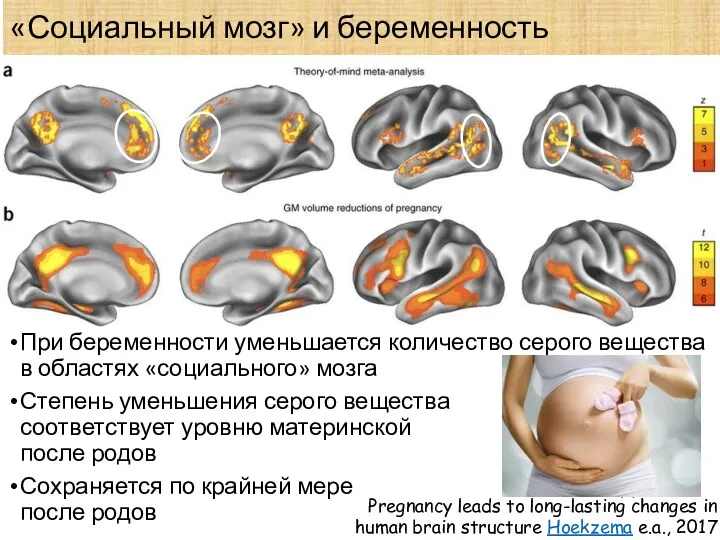 «Социальный мозг» и беременность При беременности уменьшается количество серого вещества