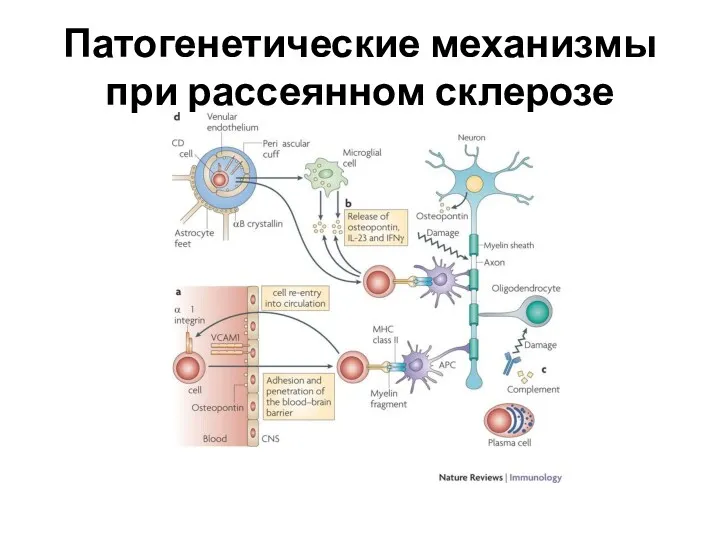 Патогенетические механизмы при рассеянном склерозе