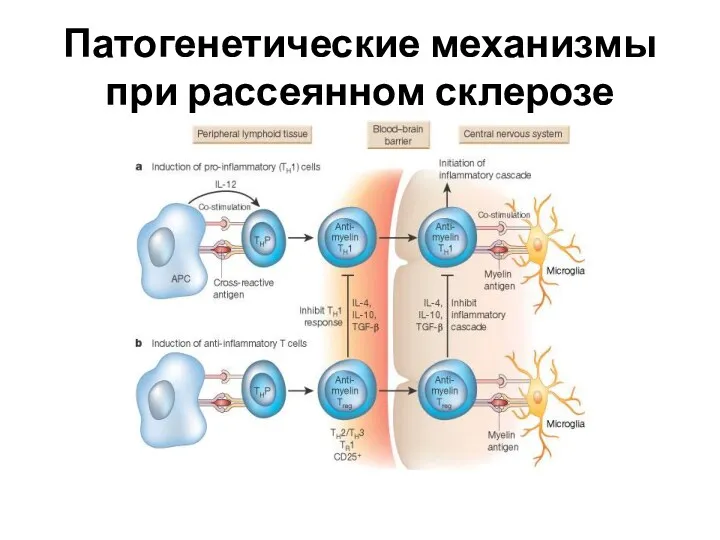 Патогенетические механизмы при рассеянном склерозе