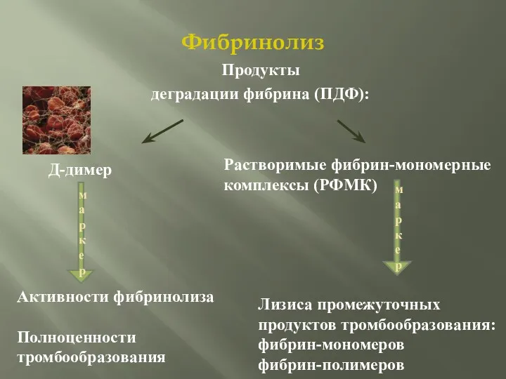 Фибринолиз Продукты деградации фибрина (ПДФ): Растворимые фибрин-мономерные комплексы (РФМК) Д-димер