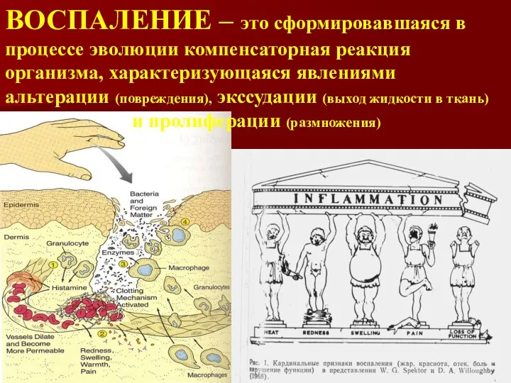 ВОСПАЛЕНИЕ – это сформировавшаяся в процессе эволюции компенсаторная реакция организма,