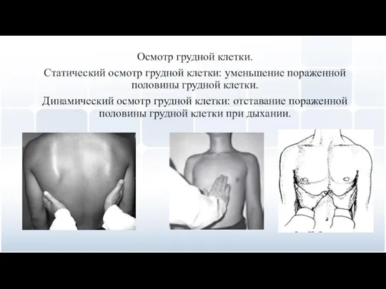 Осмотр грудной клетки. Статический осмотр грудной клетки: уменьшение пораженной половины