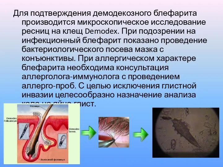Для подтверждения демодекозного блефарита производится микроскопическое исследование ресниц на клещ