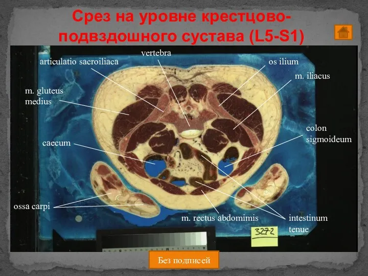 Срез на уровне крестцово-подвздошного сустава (L5-S1) Без подписей