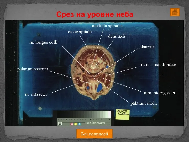 Без подписей Срез на уровне неба