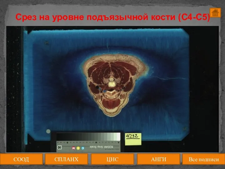 Срез на уровне подъязычной кости (C4-C5) СООД ЦНС АНГИ СПЛАНХ Все подписи