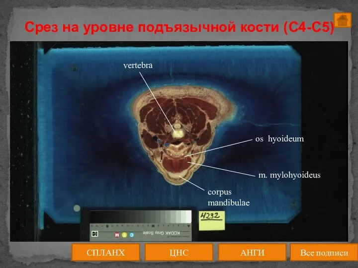 Срез на уровне подъязычной кости (C4-C5) ЦНС АНГИ СПЛАНХ Все подписи