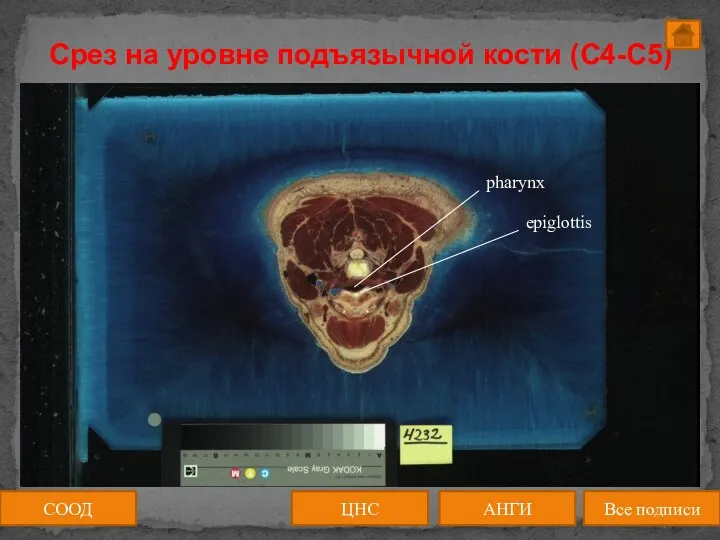 Срез на уровне подъязычной кости (C4-C5) СООД ЦНС АНГИ Все подписи