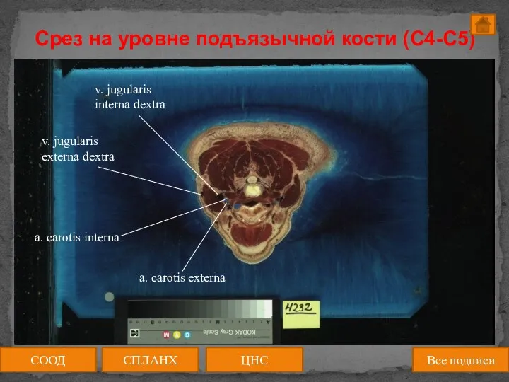 Срез на уровне подъязычной кости (C4-C5) СООД ЦНС СПЛАНХ Все подписи