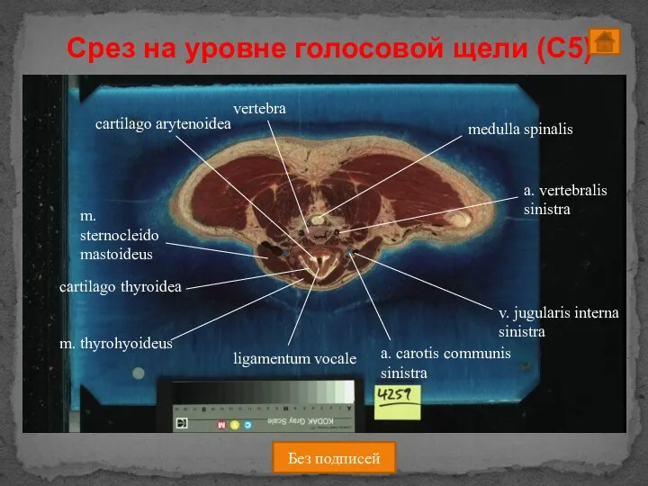 Срез на уровне голосовой щели (C5) Без подписей