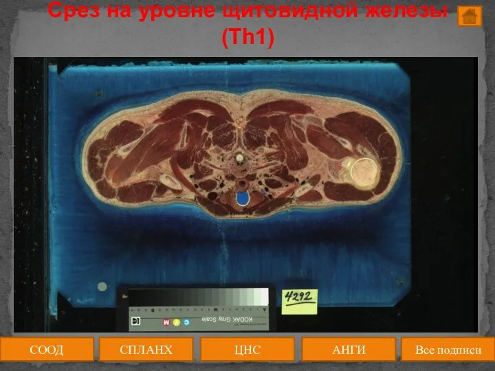 Срез на уровне щитовидной железы (Th1) СООД ЦНС АНГИ СПЛАНХ Все подписи