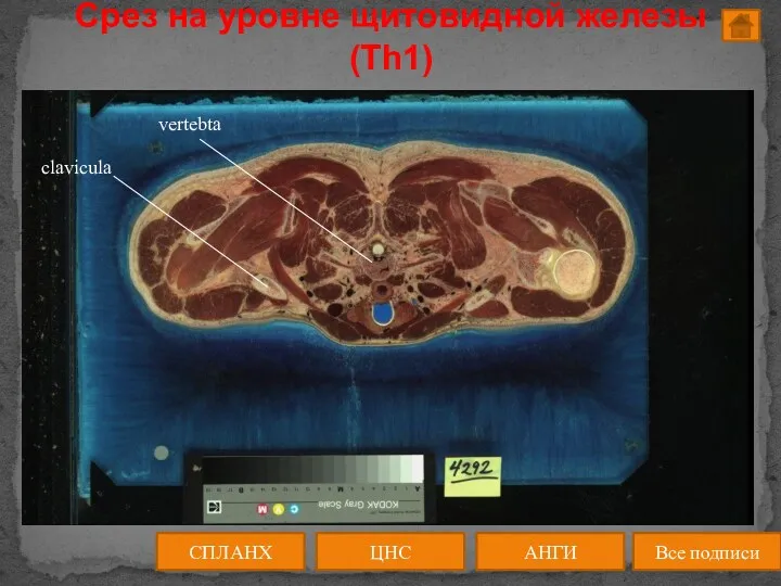 Срез на уровне щитовидной железы (Th1) ЦНС АНГИ СПЛАНХ Все подписи