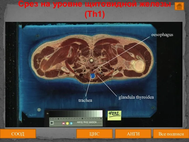Срез на уровне щитовидной железы (Th1) СООД ЦНС АНГИ Все подписи