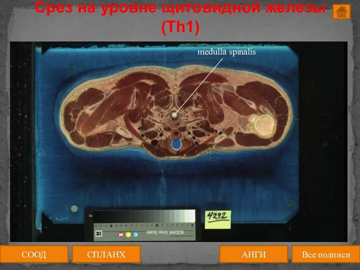 Срез на уровне щитовидной железы (Th1) СООД АНГИ СПЛАНХ Все подписи