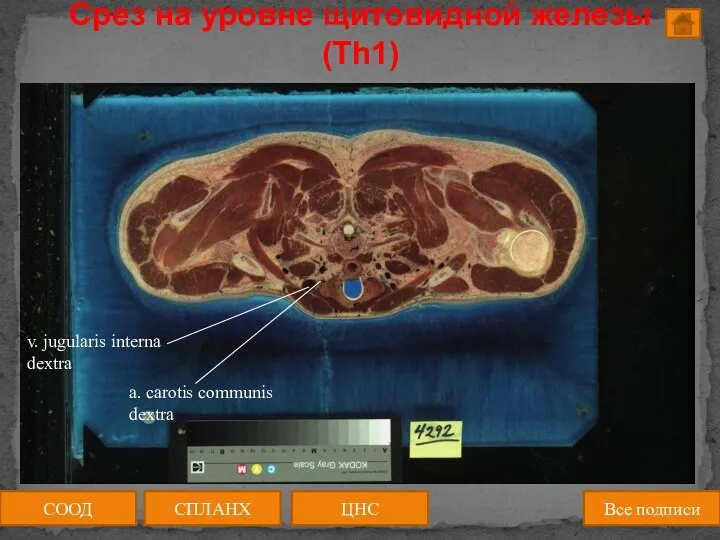Срез на уровне щитовидной железы (Th1) СООД ЦНС СПЛАНХ Все подписи