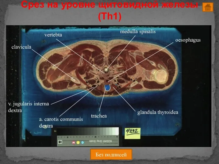 Срез на уровне щитовидной железы (Th1) Без подписей