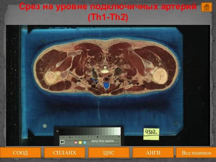 Срез на уровне подключичных артерий (Th1-Th2) ЦНС АНГИ СПЛАНХ Все подписи СООД