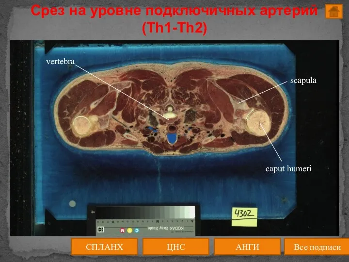 Срез на уровне подключичных артерий (Th1-Th2) ЦНС АНГИ СПЛАНХ Все подписи