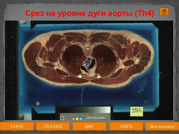 Срез на уровне дуги аорты (Th4) СООД ЦНС АНГИ СПЛАНХ Все подписи