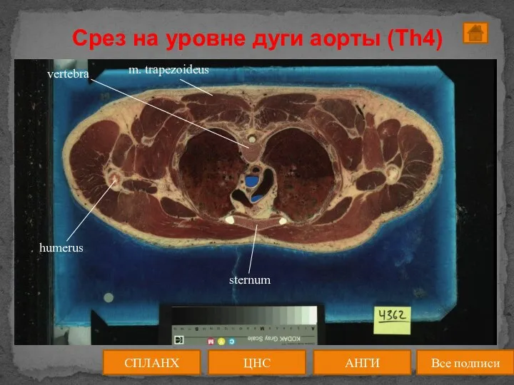 Срез на уровне дуги аорты (Th4) ЦНС АНГИ СПЛАНХ Все подписи