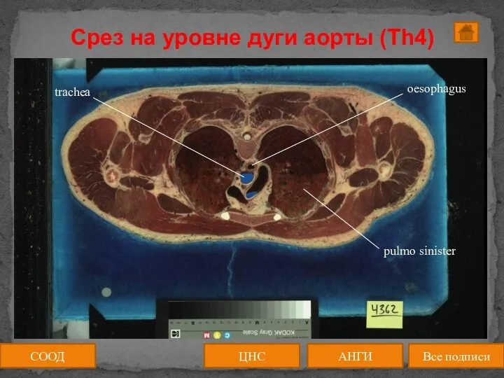 Срез на уровне дуги аорты (Th4) СООД ЦНС АНГИ Все подписи