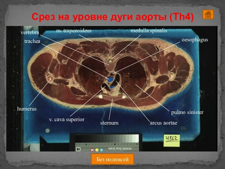 Срез на уровне дуги аорты (Th4) Без подписей