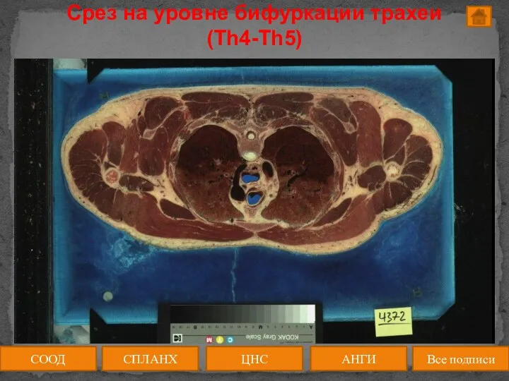 Срез на уровне бифуркации трахеи (Th4-Th5) ЦНС АНГИ СПЛАНХ Все подписи СООД