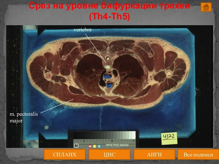 ЦНС АНГИ СПЛАНХ Все подписи Срез на уровне бифуркации трахеи (Th4-Th5)