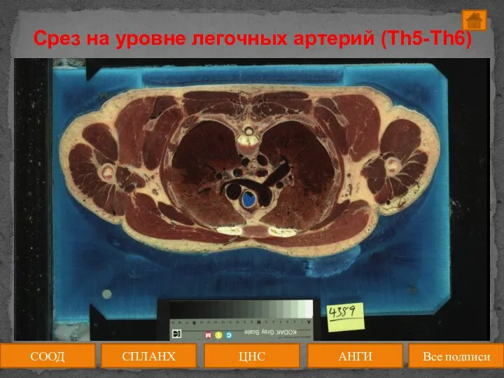 Срез на уровне легочных артерий (Th5-Th6) СООД ЦНС АНГИ СПЛАНХ Все подписи