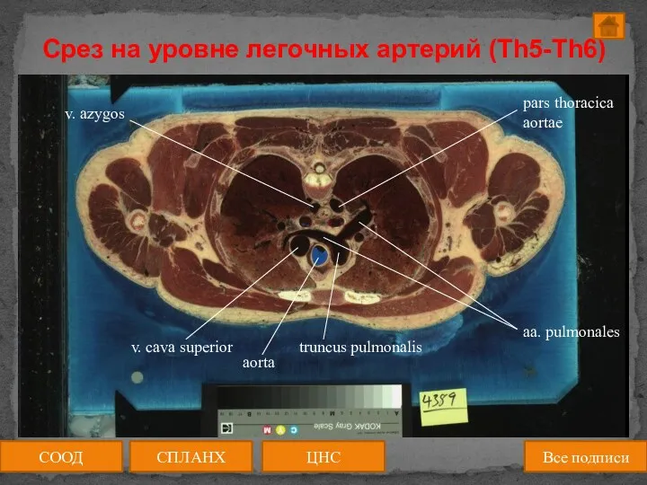 Срез на уровне легочных артерий (Th5-Th6) СООД ЦНС СПЛАНХ Все подписи