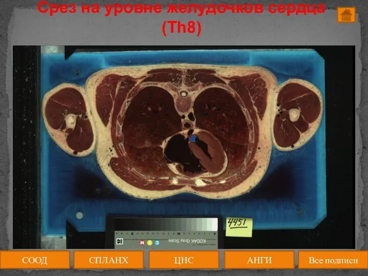 Срез на уровне желудочков сердца (Th8) СООД ЦНС АНГИ СПЛАНХ Все подписи