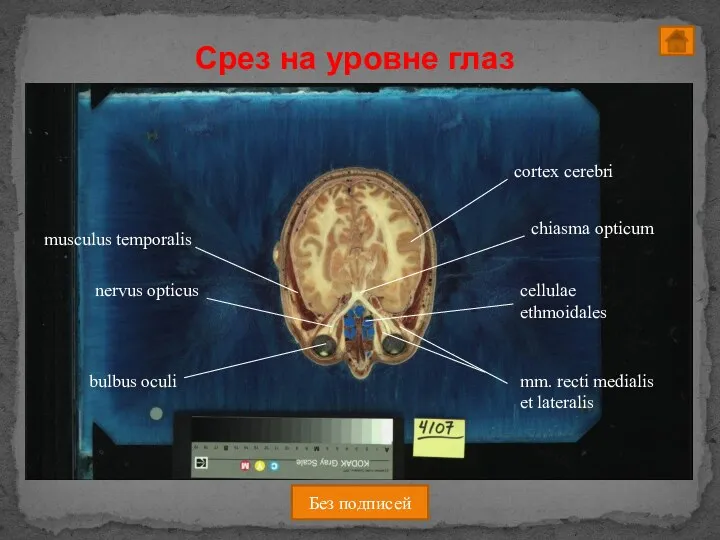 Срез на уровне глаз Без подписей