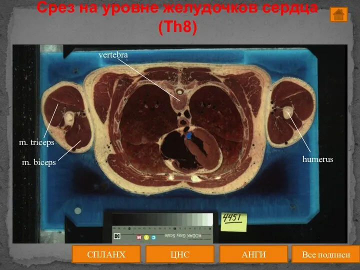 Срез на уровне желудочков сердца (Th8) ЦНС АНГИ СПЛАНХ Все подписи