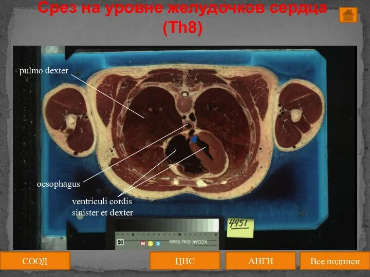 Срез на уровне желудочков сердца (Th8) СООД ЦНС АНГИ Все подписи