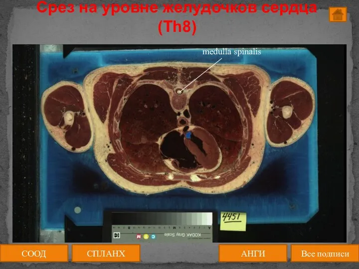 Срез на уровне желудочков сердца (Th8) СООД АНГИ СПЛАНХ Все подписи