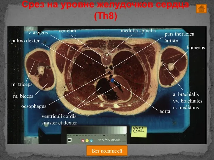 Срез на уровне желудочков сердца (Th8) Без подписей