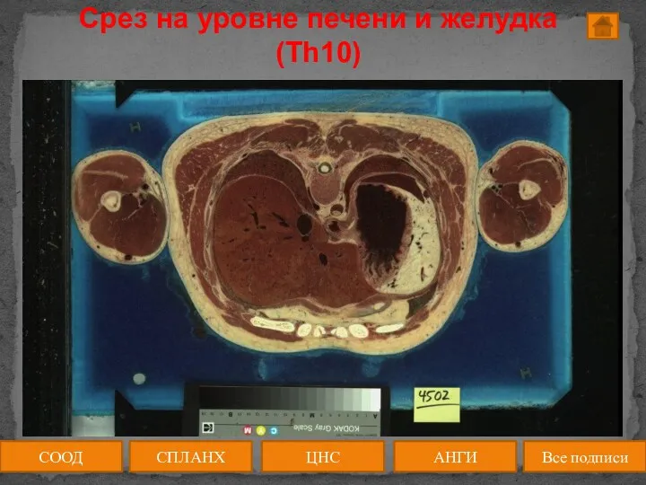 Срез на уровне печени и желудка (Th10) СООД ЦНС АНГИ СПЛАНХ Все подписи