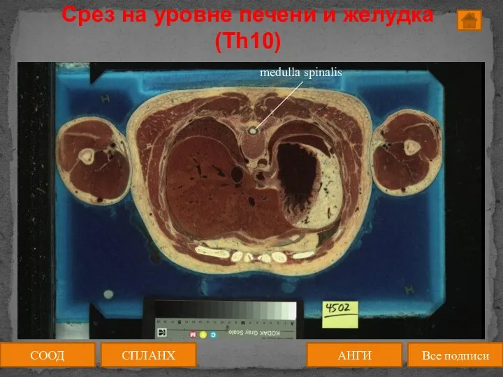 Срез на уровне печени и желудка (Th10) СООД АНГИ СПЛАНХ Все подписи